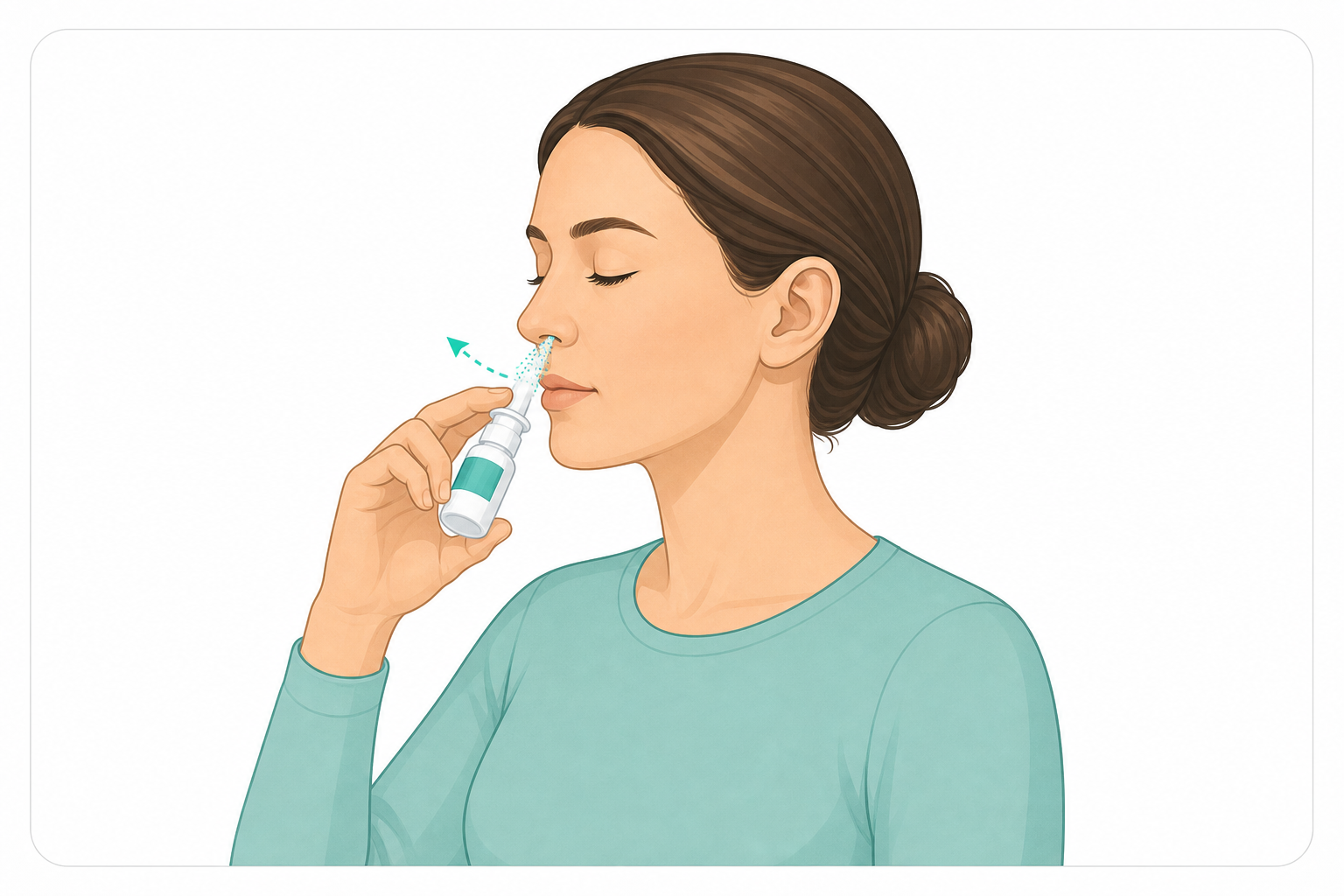 Clinical illustration showing nasal spray administration positioning