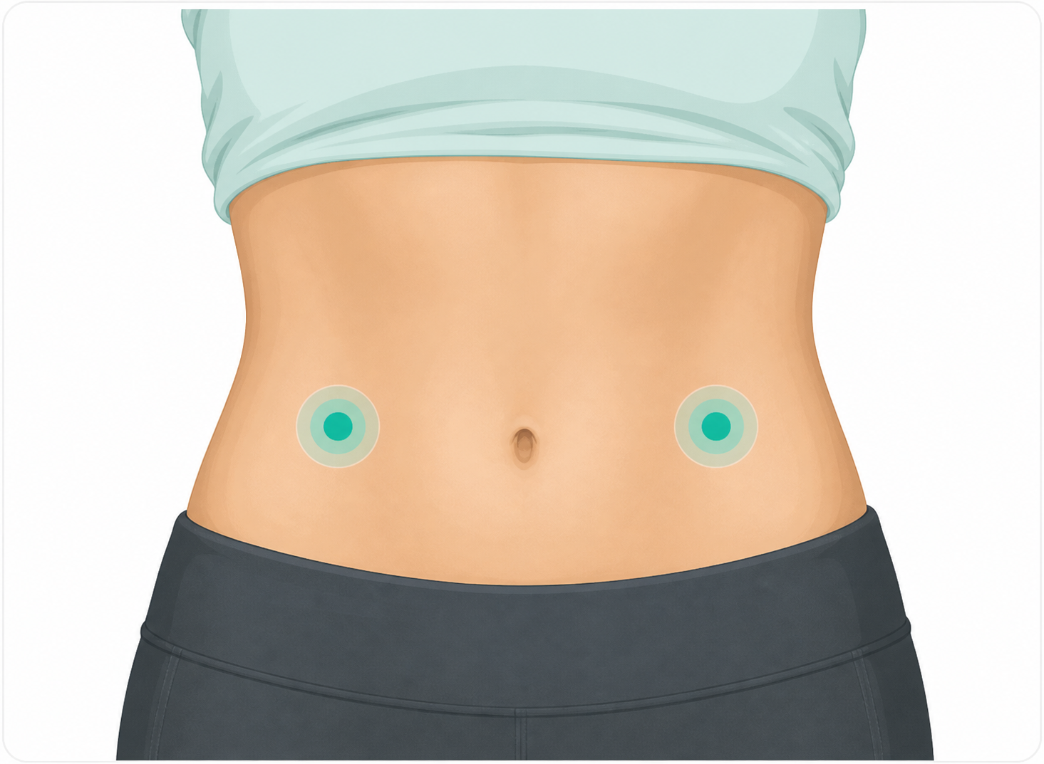 Clinical illustration showing two abdomen injection site reference areas for subcutaneous injection